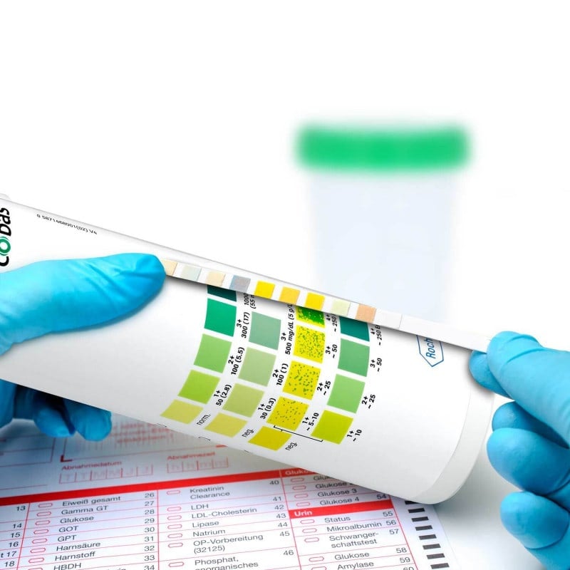 Roche Combur-9 Urine Test Strips - 50 Strips - Professional Diagnostic Strips